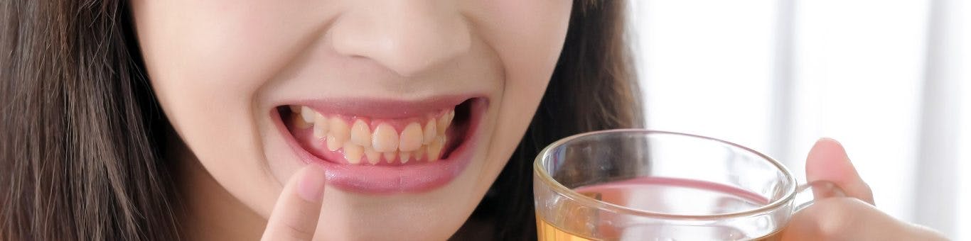 Closeup photo of lower half of woman's face, smiling with yellow teeth and holding tea.