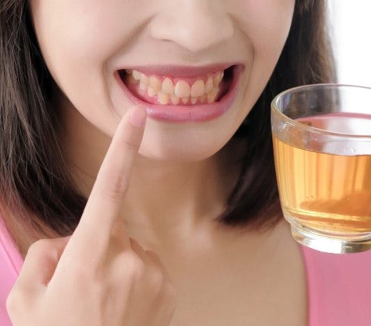 Closeup photo of lower half of woman's face, smiling with yellow teeth and holding tea.