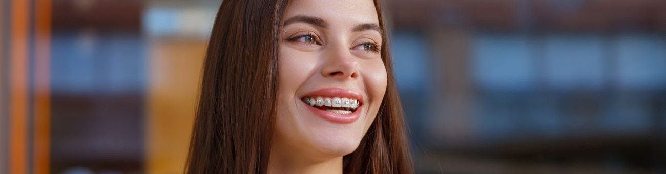 A woman smiling with ceramic braces.