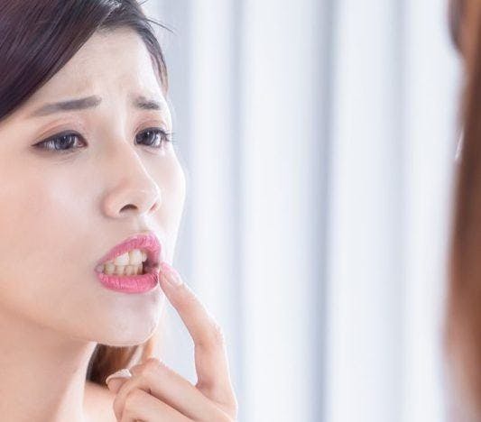 Woman worrying about her teeth in front of the mirror.