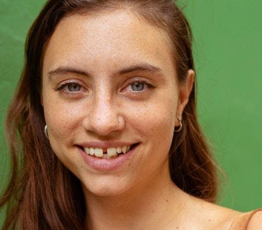 Smiling Caucasian woman with gap teeth against a green background.