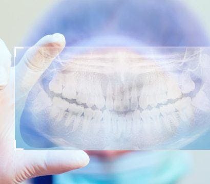 Dentist holding an image of a dental X-ray.