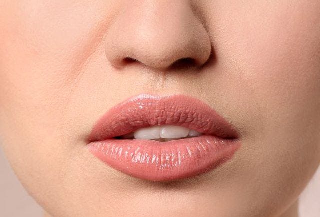 Cropped photo of a woman’s protruded lips showing front teeth.