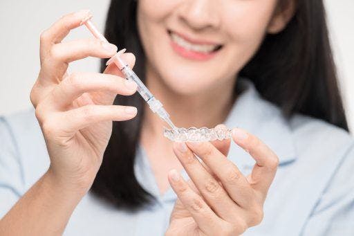 Woman applying teeth whitening gel into an aligner.