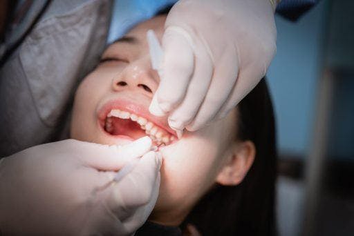 Closeup of woman getting her teeth checked by a dentist. 