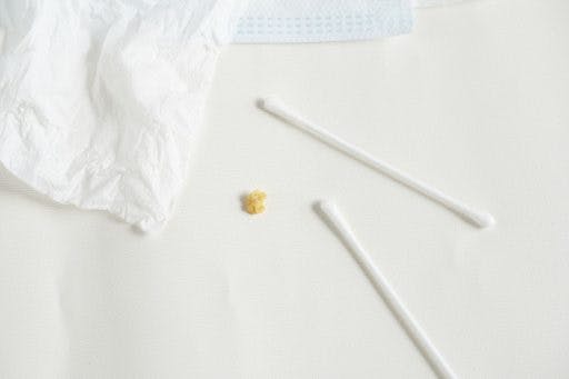 A tonsil stone on a white background surrounded with cotton swabs and a piece of tissue. 
