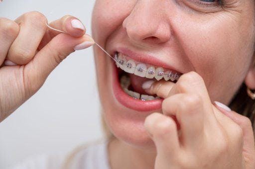 Close-up of a woman flossing with braces.