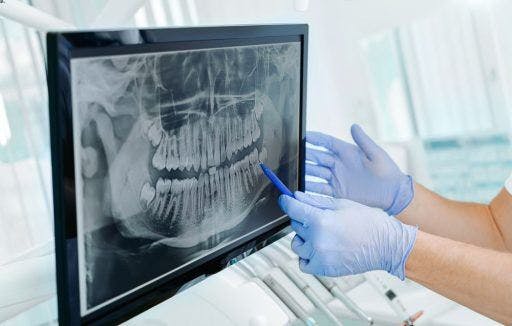 A dentist pointing to a panoramic dental X-ray.