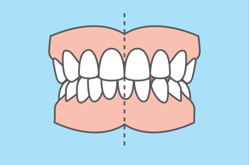 An illustration of the dental midline on teeth.