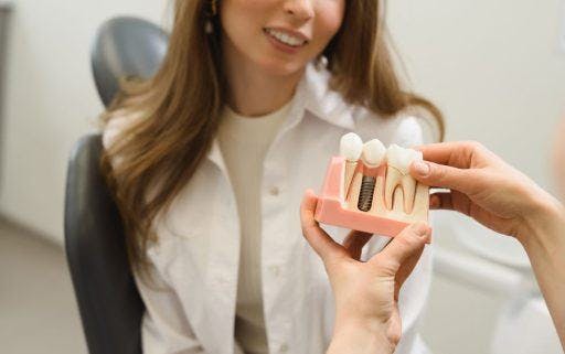 A doctor holding a large-scale 3D model of dental implants.