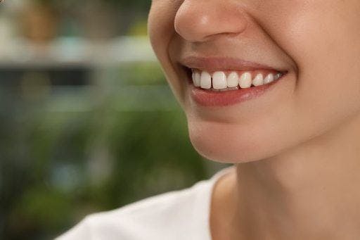 Cropped photo of woman smiling with crooked teeth.